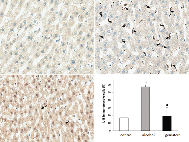  Effect of genistein on immunohistochemical staining of  interleukin-18 in rat liver