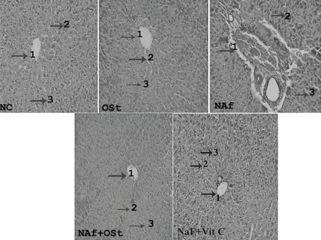 Effect of Carvacrol on Liver tissue in Fluorosis rats