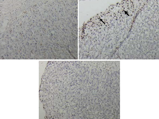  Representative gastric sections processed for the apoptosis  assay by terminal deoxynucleotidyl transferase-mediated