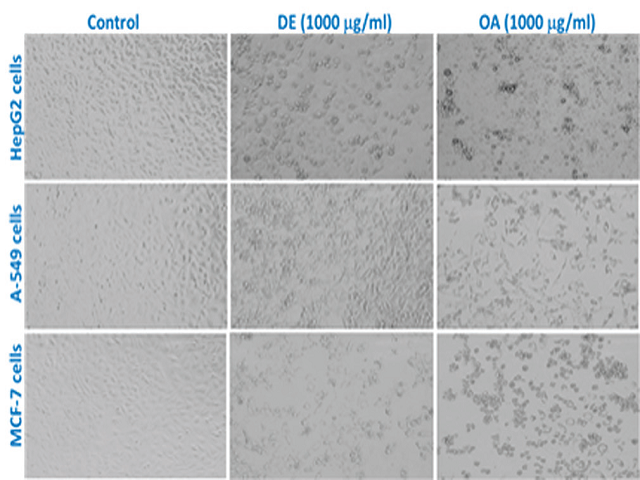  Morphological changes in HepG2, A-549, and MCF-7  cells  following the exposure 