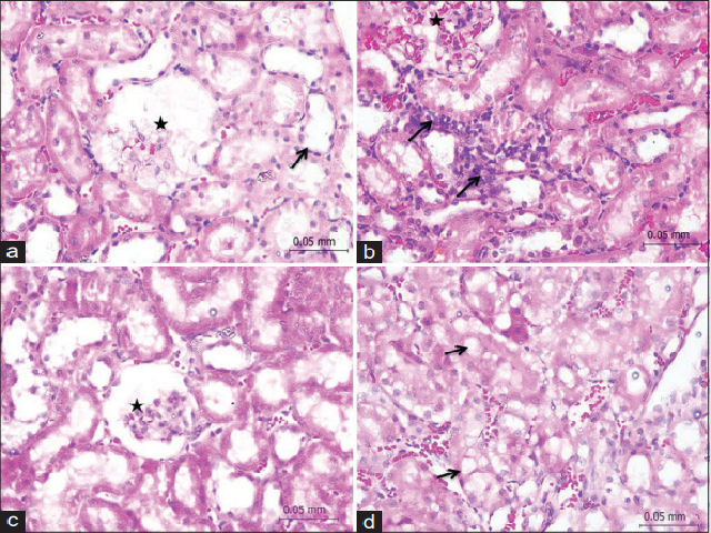 Photomicrograph of the kidneys. 
