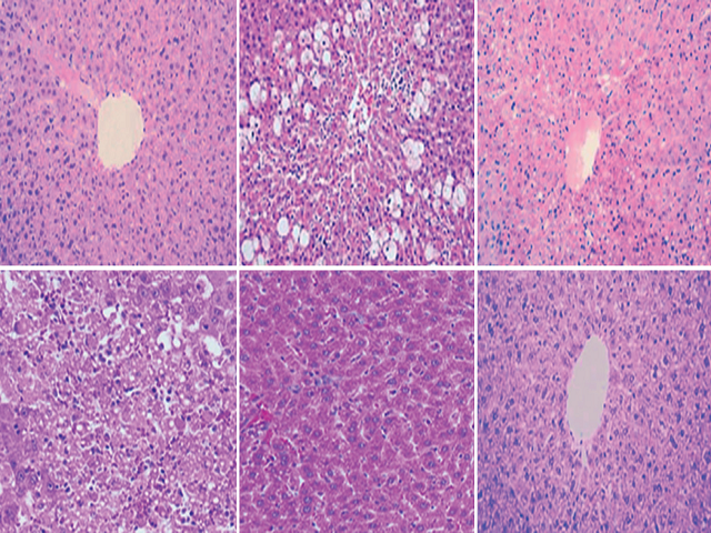 Histopathological appearance of rat liver cells
