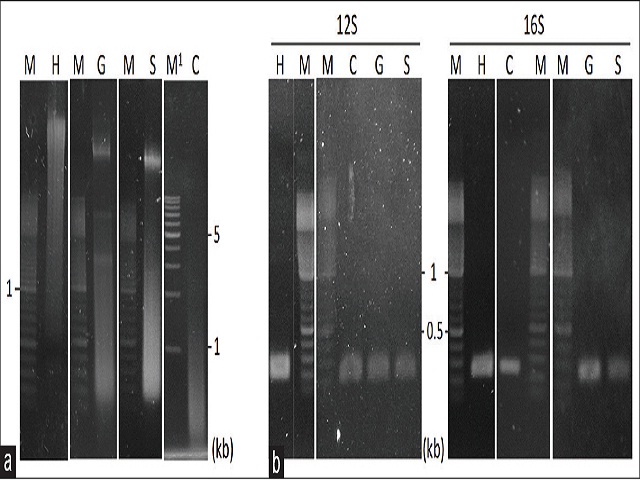 DNA isolation of fresh placenta and polymerase chain reaction amplification, (a) DNA extraction of fresh placenta