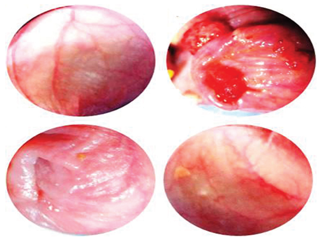 Photomicrograph showing the gross appearance  of oral mucosa in the control and experimental hamsters