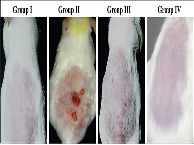  Photomicrograph showing the gross appearance, skin tumor  in the skin tissues of experimental mice