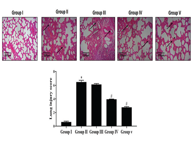 Effect of Bilobalide on reduces cecal ligation and puncture‑induced inflammatory response in septic mice. The normal alveolar tissue architecture and no inflammatory conditions were noted in control (Group I). The excessive inflammatory cells infiltration, alveolar damages, and edema were noted in sepsis‑induced mice (Group II). Bilobalide (20, 40, and 80 mg/kg) pretreatment repressed the inflammatory cell permeation and histopathological alterations in the lungs (Group III‑V). Values were depicted as a mea
