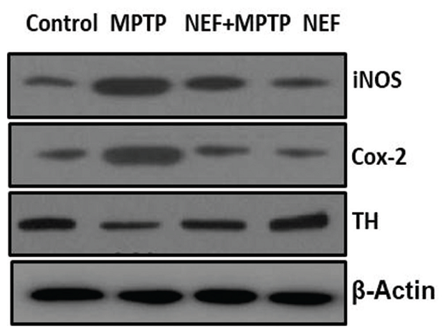 Neuroprotective effect of alkaloid neferine on inducible nitric oxide synthase, cylcooxygenase‑2 and TH protein expression in the substantia nigra tissue of Parkinson’s disease‑induced mice.