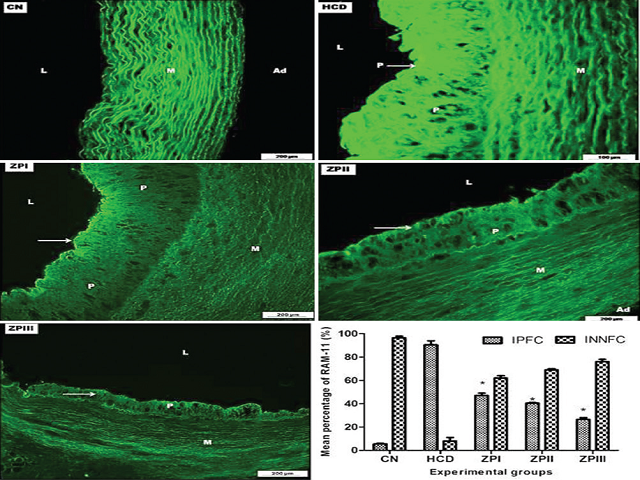 Photomicrograph of thoracic aortas from CN, HCD, ZPI, ZPII, and ZPIII groups symbolize immunoflourescent staining with RAM‑11 antibody. Control group shows no immunopositive reaction.