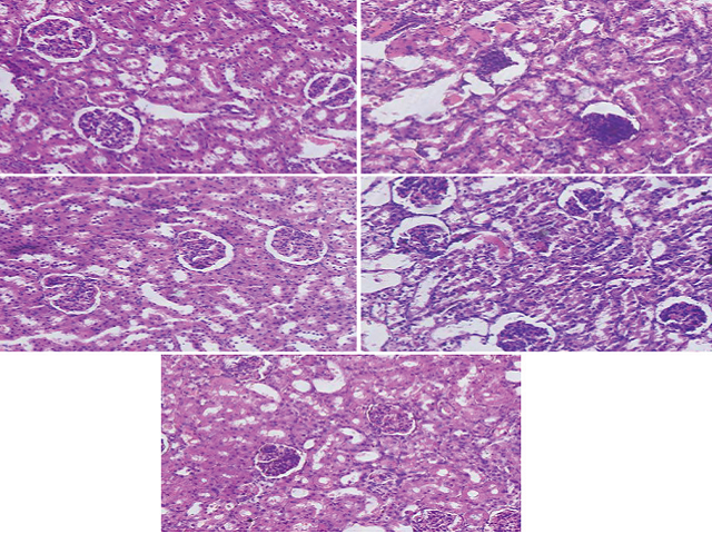 Effects of Grape Seed Proanthocyanidin Extract on Cisplatin‑Induced Renal Oxidative Damage and Apoptosis in Rats