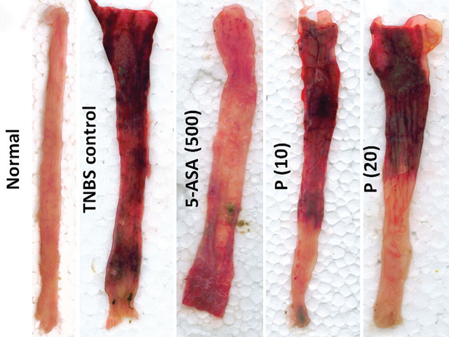 D-Pinitol-attenuated trinitrobenzene sulfonic acid-induced ulcerative colitis in experimental rats: possible through inhibition of nuclear factor-κb/nuclear factor of kappa light polypeptide gene enhancer in b-cell inhibitor-alpha pathway and activation