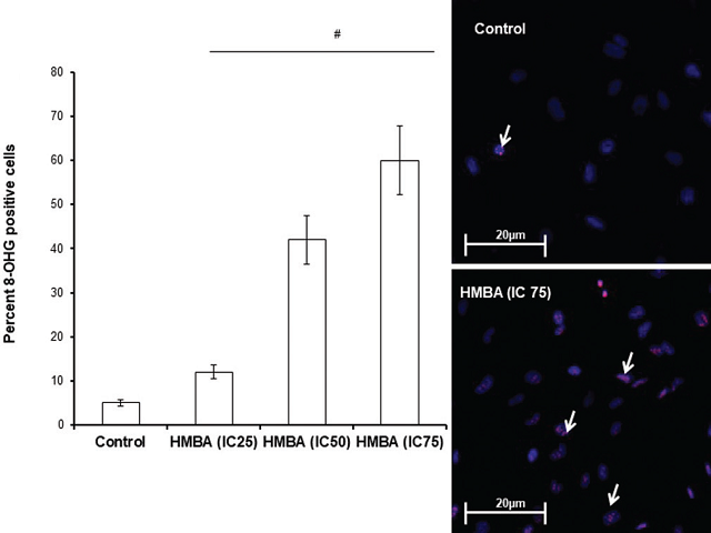 DNA damage by 2‑hydroxy‑4‑methoxy benzoic acid in control and experimental cells. Cells were treated with IC25, IC50, and IC75 concentration of 2‑hydroxy‑4‑methoxy benzoic acid for 24 h
