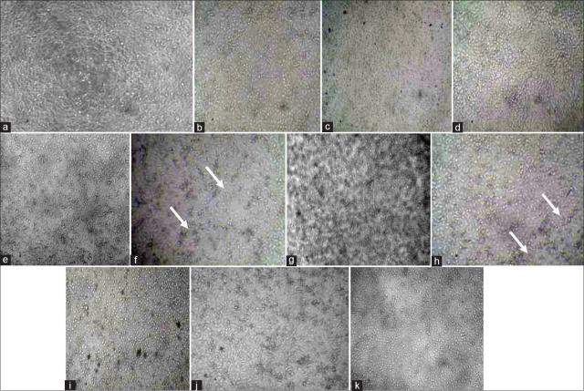 In vitro cytotoxic activity using fruits of Annona muricata and aerial parts of Euphorbia tirucalli against lung and oral cancer cell lines