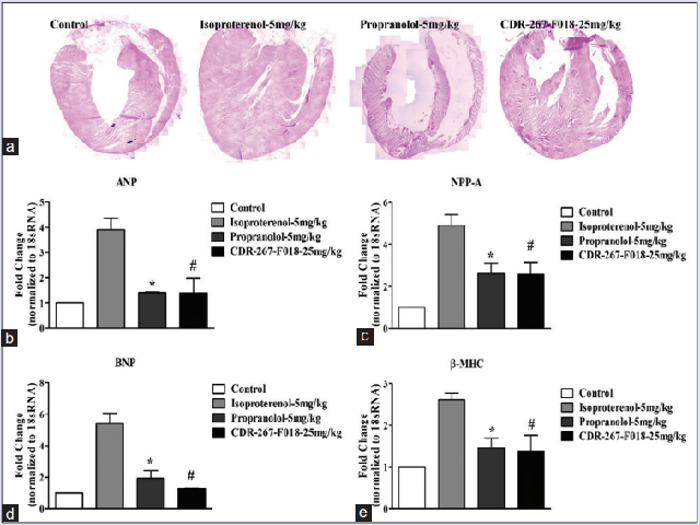 CDR-267-F018 improved functional parameter of hypertrophic heart. (a) Representative gross images of heart sagittal sections by haematoxylin  and eosin stain