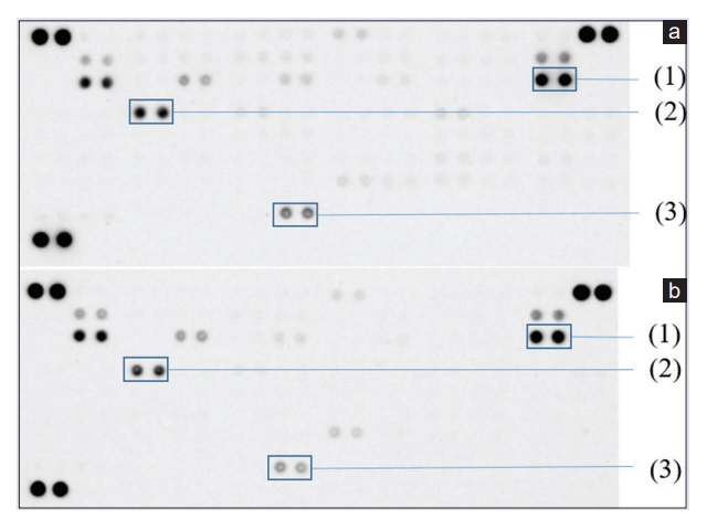 Human oncology antibody array after incubation