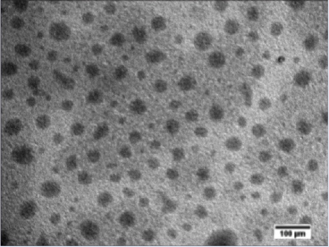 TEM observation images of Gal-SMEDDS (× 30000)