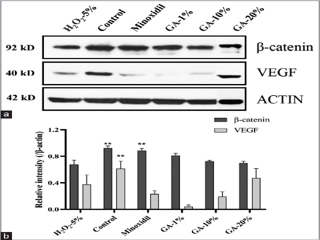(a) Western blot analysis, actin as internal control adding the  same amount of protein  (50 µg)