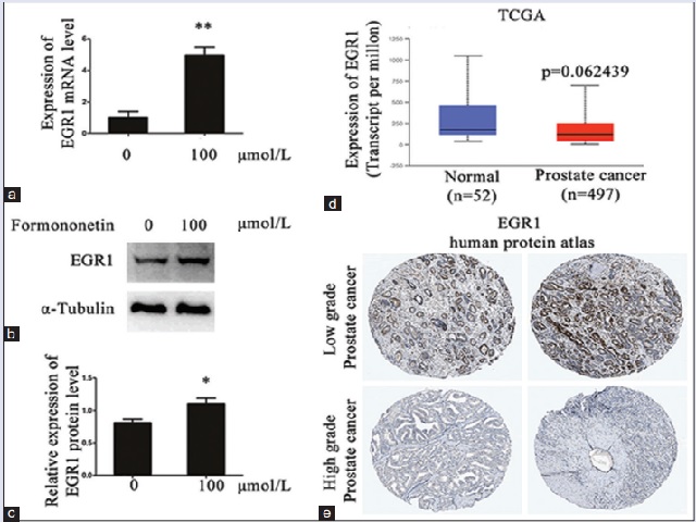 Formononetin increases EGR1 expression in DU145 and EGR1 decreases in the progression of human PCa