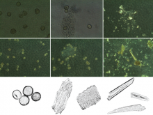 Microstructure of Pollen Typhae. (a and d): Microstructure of Pollen grain