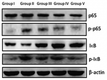 Tannic acid inhibits lipopolysaccharide-induced nuclear  factor-kB activation