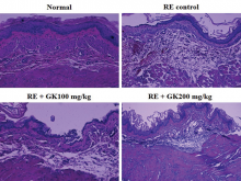 Hematoxylin and eosin-stained sections of esophagus