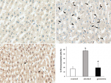  Effect of genistein on immunohistochemical staining of  interleukin-18 in rat liver