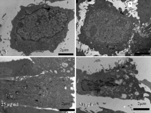 The cells were treated with Gallic acid