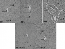 Effect of Carvacrol on Liver tissue in Fluorosis rats