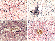 Hepatoprotective effect of oleanolic acid