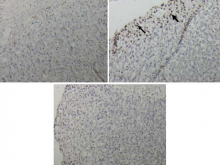  Representative gastric sections processed for the apoptosis  assay by terminal deoxynucleotidyl transferase-mediated