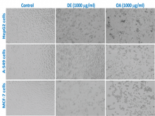  Morphological changes in HepG2, A-549, and MCF-7  cells  following the exposure 
