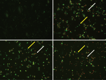 Human cervical carcinoma cells processed with Annexin-V-Fluos 