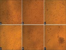  Morphological changes of PA-1 cells after 72 h of treatment