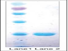 Sodium dodecyl sulfate–polyacrylamide gel electrophoresis 