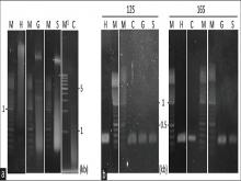DNA isolation of fresh placenta and polymerase chain reaction amplification, (a) DNA extraction of fresh placenta