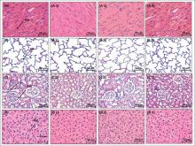 Histopathological observations of vital organs. Control mice injected with only saline and all treated organs showing normal tissue patterns