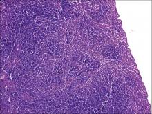  Histopathology of spleen of Swiss albino mice in control group  receiving vehicle at 12th day