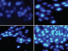 Effect of Artemisia absinthium L. on apoptosis induction