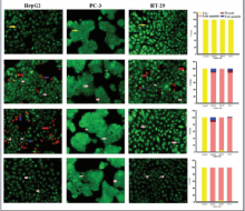  Cell apoptosis observed using fluorescence microscope (×200). Cells were treated with IC50S