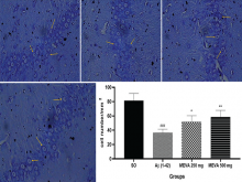 Histology of CA1 region of hippocampus stained with cresyl violet stain after 28 days of the experimental protocol (×40)