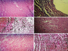 Histopathological sections of the rat kidney; (a) Control (b) ISP (c) SD (d) ISP + JM (400 mg/kg) (e) ISP + JM (600 mg/kg) (f) ISP + JM (800 mg/kg). ISP: Isoproterenol; SD: Standard drug; JM: Jatropha mollissima