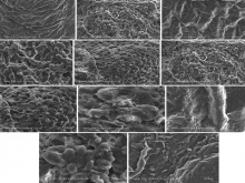 Scanning electronic microscopy of heart tissue in different groups