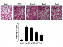 Effect of Bilobalide on reduces cecal ligation and puncture‑induced inflammatory response in septic mice. The normal alveolar tissue architecture and no inflammatory conditions were noted in control (Group I). The excessive inflammatory cells infiltration, alveolar damages, and edema were noted in sepsis‑induced mice (Group II). Bilobalide (20, 40, and 80 mg/kg) pretreatment repressed the inflammatory cell permeation and histopathological alterations in the lungs (Group III‑V). Values were depicted as a mea