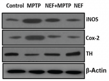 Neuroprotective effect of alkaloid neferine on inducible nitric oxide synthase, cylcooxygenase‑2 and TH protein expression in the substantia nigra tissue of Parkinson’s disease‑induced mice.