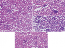Effects of Grape Seed Proanthocyanidin Extract on Cisplatin‑Induced Renal Oxidative Damage and Apoptosis in Rats