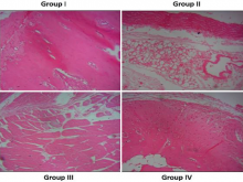 Antiresproative Potency of D‑carvone on Ovariectomy‑Induced Osteoporosis in Rats