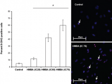DNA damage by 2‑hydroxy‑4‑methoxy benzoic acid in control and experimental cells. Cells were treated with IC25, IC50, and IC75 concentration of 2‑hydroxy‑4‑methoxy benzoic acid for 24 h