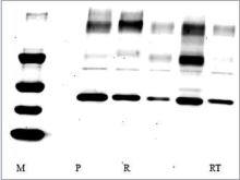  HER2 expression (1) Parent (2) Resistant (5) Resistant cells after  treatment with CR PLGA-PEG F68 nanoparticles