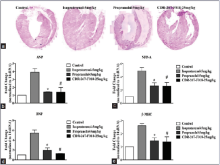 CDR-267-F018 improved functional parameter of hypertrophic heart. (a) Representative gross images of heart sagittal sections by haematoxylin  and eosin stain