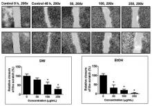 Cratoxylum formosum leaf extracts inhibit growth, induce apoptosis, and decrease metastasis of hela human cervical cancer cells