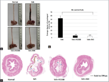 Effects of FCt on esophageal reflux induced esophageal mucosal damage in rats. Gross (a), the ratio of esophageal damage (b) and histological  changes of esophagus induced by gastric acid reflux (scale bar: 200 µm) (c)